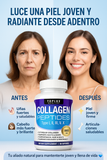 Con Collagen Peptides: Recupera tu juventud 💆‍♀️y ten una piel firme, cabello lleno de vida y huesos fuertes con 5 colágenos en 1 cápsula 💊✨ (Copia)