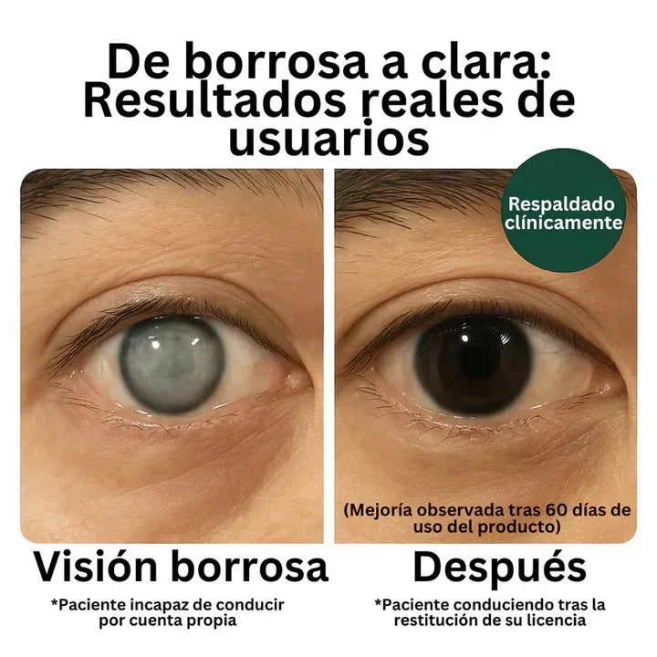 Nutre y protege tu visión todos los días 👁️✨ Con la formula de ZOONE que tiene luteína, zeaxantina y vitamina C 💊
