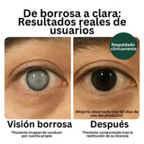 Nutre y protege tu visión todos los días 👁️✨ Con la formula de ZOONE que tiene luteína, zeaxantina y vitamina C 💊
