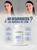 CLEARSTEM: Desintoxica Hoormonas, Calma el Estrés y Logra una Piel Clara desde el Interior